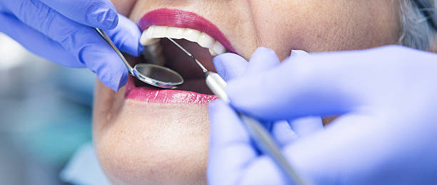 Best Emergency Dental Surgery in Mount Carmel, IL